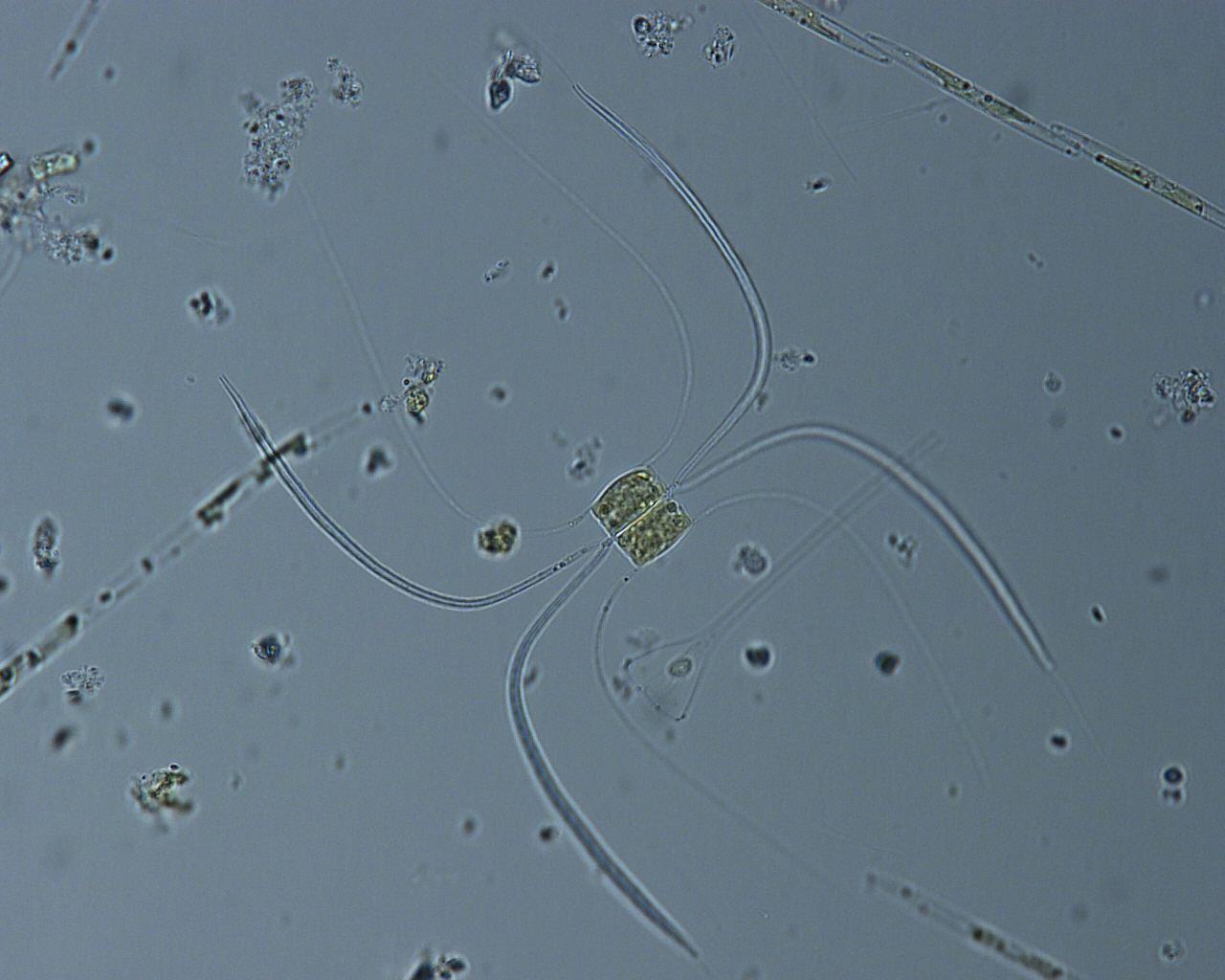 Dictyocha speculum